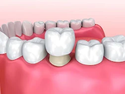 Dental Clinic in Anna Nagar Madurai